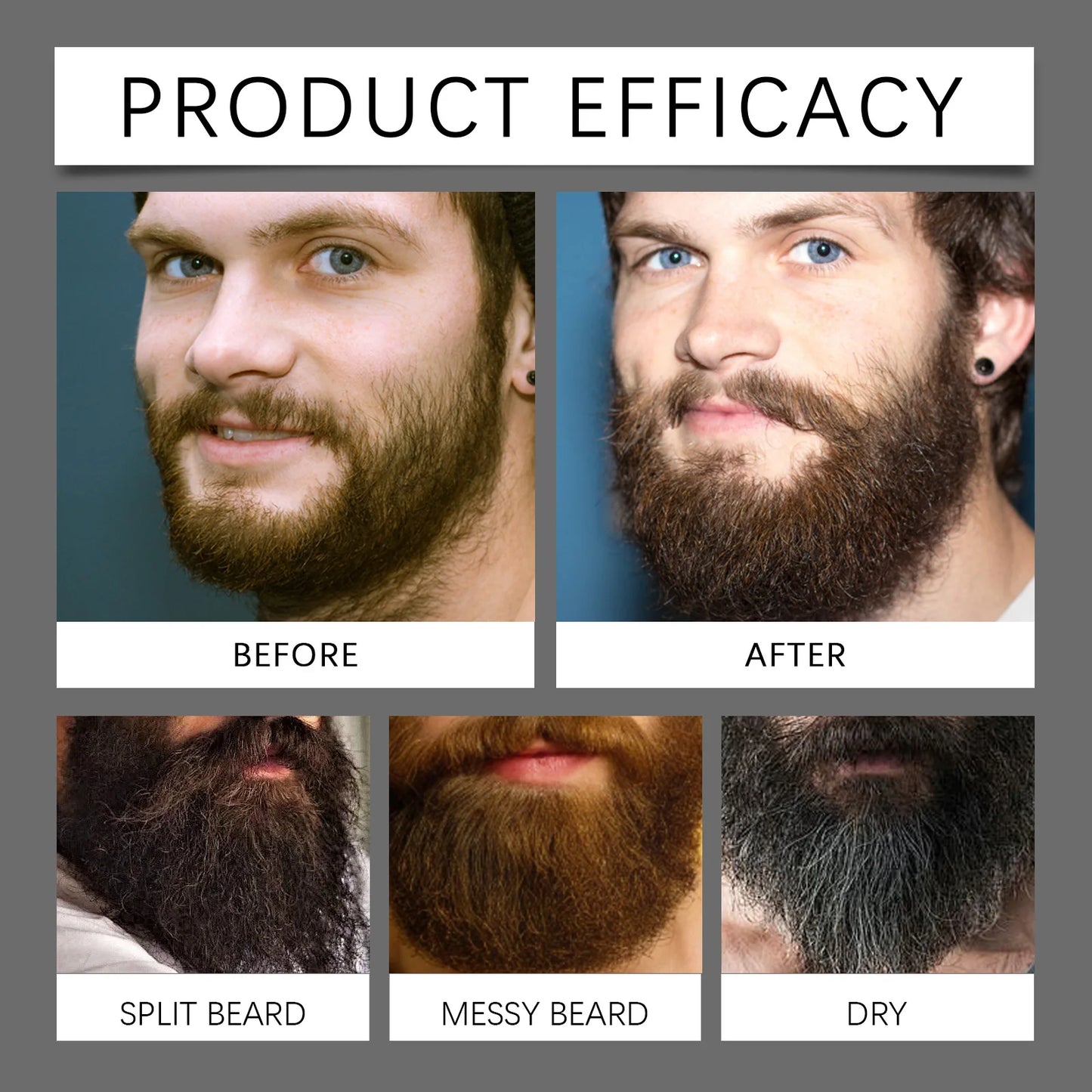 Full Beard – Pack Sérum Stimulant